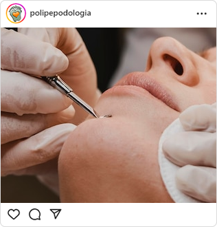 Poli-Pé, podologia, guarulhos