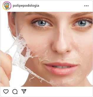 Poli-Pé, podologia, guarulhos