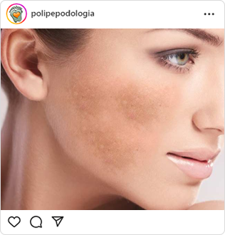 Poli-Pé, podologia, guarulhos