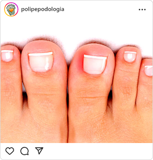 Poli-Pé, podologia, guarulhos