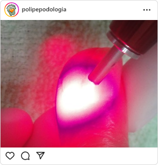 Poli-Pé, podologia, guarulhos